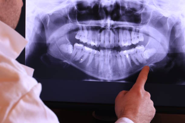 Best Emergency Denture Repair in Washington, PA