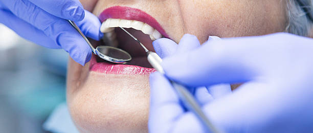 Best Emergency Dental Care for Sports Injuries in Washington, PA
